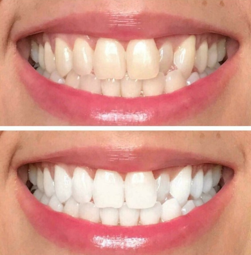 AP 24 Toothpaste Flouride Formula